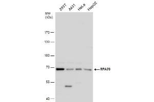 WB Image RPA70 antibody detects RPA70 protein by western blot analysis.