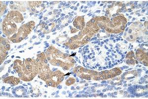 Human kidney; Rabbit Anti-L3MBTL2 Antibody. (L3MBTL2 anticorps  (C-Term))
