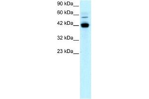 WB Suggested Anti-EGR1 Antibody Titration: 1 ug/ml Positive Control: Jurkat cell lysate (EGR1 anticorps  (N-Term))