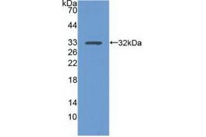 Detection of Recombinant ITGa1, Human using Polyclonal Antibody to Integrin Alpha 1 (ITGa1) (Integrin alpha 1 anticorps  (AA 125-366))