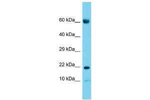 Host: Rabbit Target Name: CNIH2 Sample Type: Placenta lysates Antibody Dilution: 1. (CNIH2 anticorps  (N-Term))