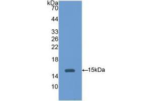 Western blot analysis of recombinant Mouse HEXb. (HEXB anticorps  (AA 101-217))