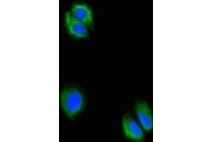 Immunofluorescent analysis of HepG2 cells using ABIN7175061 at dilution of 1:100 and Alexa Fluor 488-congugated AffiniPure Goat Anti-Rabbit IgG(H+L) (C5orf51 anticorps  (AA 8-152))