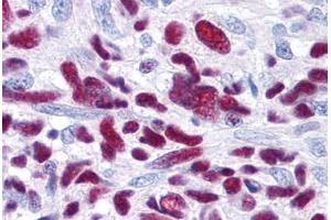 Glioblastoma (GLI3 anticorps  (AA 41-57))