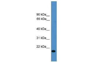 VEGFB antibody used at 0.