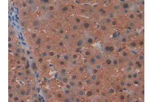 IHC-P analysis of Human Liver Tissue, with DAB staining. (ARIP4 anticorps  (AA 638-837))