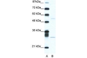 WB Suggested Anti-ATF4  Antibody Titration: 5. (ATF4 anticorps  (C-Term))
