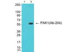 Western blot analysis of extracts from cos-7 cells (Lane 2), using PAK1 (Ab-204) antiobdy. (PAK1 anticorps  (Ser204))
