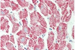 anti-Glutaredoxin 3 (GLRX3) (AA 81-110) antibody