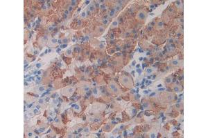 Used in DAB staining on fromalin fixed paraffin- embedded stomach tissue (Neuregulin 2 anticorps  (AA 618-836))