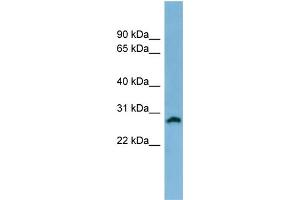 WB Suggested Anti-SRD5A2 Antibody Titration: 0. (SRD5A2 anticorps  (N-Term))