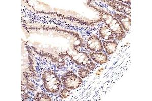 Immunohistochemistry of paraffin embedded rat small intestine using ZC3H11A (ABIN7076255) at dilution of 1: 6000 (250x lens)