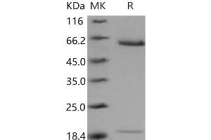 Western Blotting (WB) image for Proprotein Convertase Subtilisin/kexin Type 9 (PCSK9) (Active) protein (His tag) (ABIN7320347)