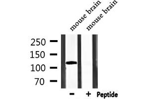 Western blot analysis of extracts from mouse brain, using TRPM8 Antibody.