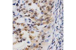 Immunohistochemistry (IHC) image for anti-Histone H3 (H3) (H3K36me3) antibody (ABIN3016039)