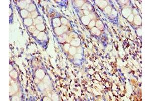 Immunohistochemistry of paraffin-embedded human colon tissue using ABIN7142909 at dilution of 1:100 (AKAP5 anticorps  (AA 1-270))