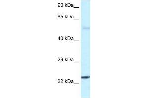 Western Blot showing RAB31 antibody used at a concentration of 1 ug/ml against Fetal Brain Lysate (RAB31 anticorps  (C-Term))