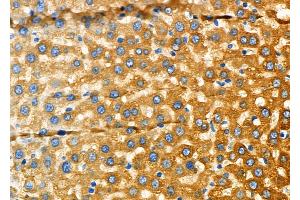ABIN6266217 and ABIN6277375 at 1/100 staining Rat liver tissue by IHC-P. (GLRA1 anticorps  (Internal Region))