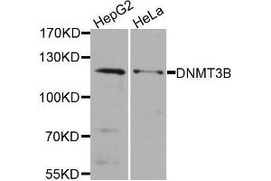 Western blot analysis of extracts of various cell lines, using DNMT3B antibody. (DNMT3B anticorps)