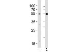 Western blot analysis of lysate from 1) human Raji cell line and 2) rat spleen tissue lysate using Lyn antibody. (LYN anticorps  (AA 229-263))