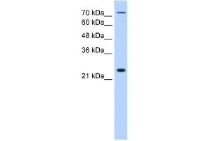 WB Suggested Anti-CLDN2 Antibody Titration:  1. (Claudin 2 anticorps  (N-Term))