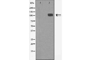 Western blot analysis of ACE2 expression in HeLa cells,The lane on the left is treated with the antigen-specific peptide.