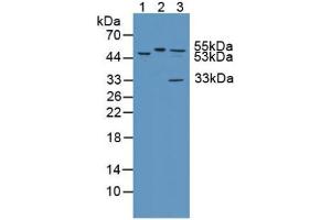 Figure. (KATNA1 anticorps  (AA 260-491))