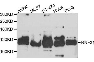 Western blot analysis of extracts of various cell lines, using RNF31 antibody. (RNF31 anticorps)