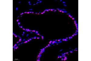 Immunofluorescence of paraffin embedded mouse bladder using PRPF4 (ABIN7075312) at dilution of 1: 500 (400x lens) (PRPF4 anticorps)
