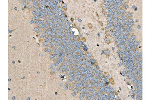 IHC analysis of LARP1 using anti-LARP1 antibody (ABIN7599861). (LARP1 anticorps  (AA 123-401))