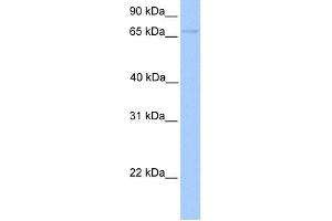 WB Suggested Anti-FOXO1 Antibody Titration:  0. (FOXO1 anticorps  (Middle Region))