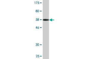 Western Blot detection against Immunogen (56. (XPO5 anticorps  (AA 1-280))