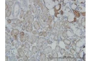 Image no. 6 for anti-Oxidative-Stress Responsive 1 (OXSR1) (AA 1-528) antibody (ABIN599106) (OXSR1 anticorps  (AA 1-528))