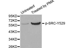 Western Blotting (WB) image for anti-Proto-oncogene tyrosine-protein kinase Src (Src) (pTyr529) antibody (ABIN1870630) (Src anticorps  (pTyr529))