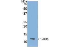 Detection of Recombinant IL8, Equine using Polyclonal Antibody to Interleukin 8 (IL8) (IL-8 anticorps  (AA 23-101))