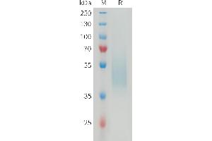 Mouse B7-H4 Protein, His Tag on SDS-PAGE under reducing condition.