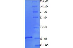 SDS-PAGE (SDS) image for Cytosol Aminopeptidase (LAP3) (AA 25-64), (partial) protein (His-SUMO Tag) (ABIN5711349)