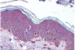 Human Skin (formalin-fixed, paraffin-embedded) stained with SERPINF1 antibody ABIN337231 at 4-8 ug/ml followed by biotinylated goat anti-rabbit IgG secondary antibody ABIN481713, alkaline phosphatase-streptavidin and chromogen.