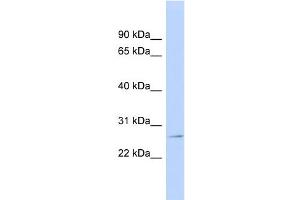 WB Suggested Anti-GSTP1 Antibody Titration:  0. (GSTP1 anticorps  (N-Term))