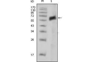 Western blot analysis using AXL mouse mAb against extracellular domain of human AXL (aa19-444). (AXL anticorps)