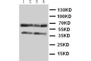 Anti-CCR5 antibody,  Western blotting Lane 1: COLO320 Cell Lysate Lane 2: MCF-7 Cell Lysate Lane 3: SMMC Cell Lysate Lane 4: JURKAT Cell Lysate