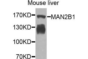 Western blot analysis of extracts of mouse liver cells, using MAN2B1 antibody.