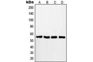Western blot analysis of RAD18 expression in MCF7 (A), A549 (B), Jurkat (C), HCT116 (D) whole cell lysates. (RAD18 anticorps  (Center))
