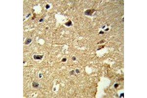IHC analysis of FFPE human brain tissue stained with anti-beta Tubulin antibody