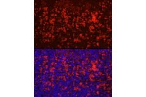 Immunofluorescence analysis of mouse spleen using CD4 Rabbit pAb (ABIN6134777, ABIN6138187, ABIN6138189 and ABIN6213821) at dilution of 1:100 (40x lens).