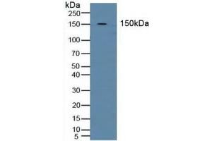 Detection of BND3 in Human Blood Cells using Polyclonal Antibody to Band 3 (BND3) (Band 3/AE1 anticorps  (AA 35-290))