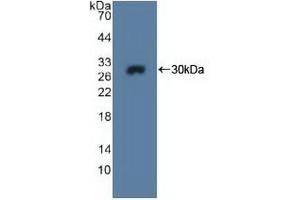 Detection of Recombinant MPG, Human using Polyclonal Antibody to N-Methylpurine DNA Glycosylase (MPG) (MPG anticorps  (AA 221-296))