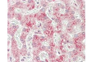 Formalin-fixed and paraffin-embedded H.