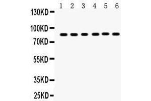 Anti-TPA Picoband antibody, Western blotting All lanes: Anti TPA  at 0. (PLAT anticorps  (AA 366-562))