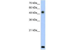 WB Suggested Anti-RSAD2 Antibody Titration:  2. (RSAD2 anticorps  (N-Term))